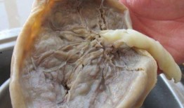 四个月胎盘吃瓜,孕育生命的奇妙旅程